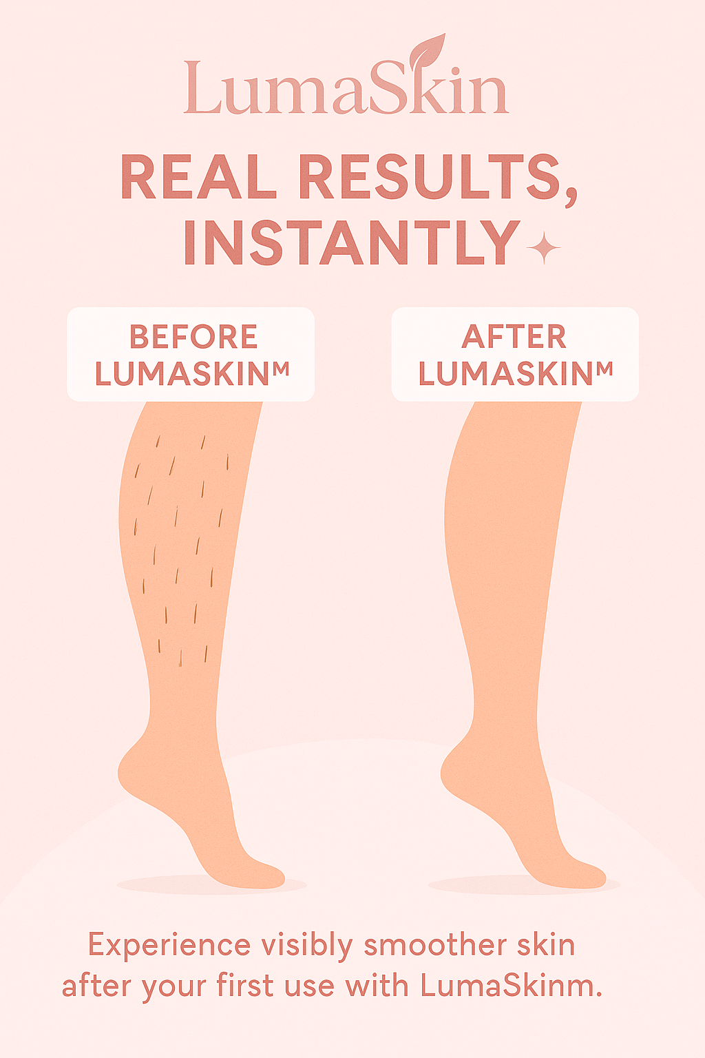 Depiladora LumaSkin