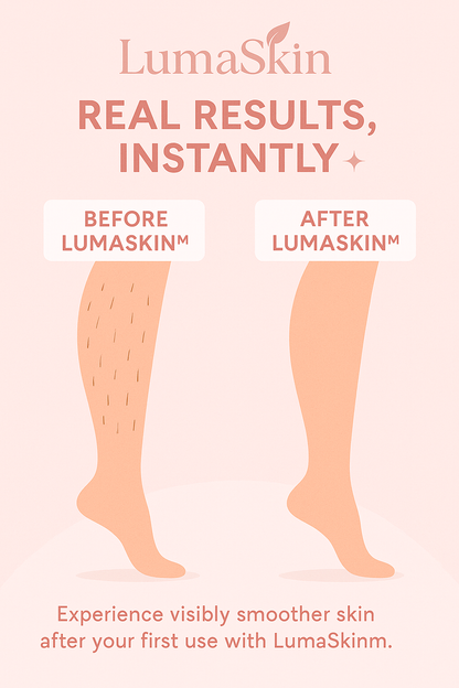 Depiladora LumaSkin 
